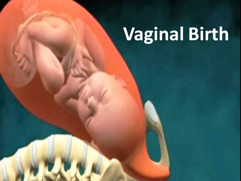 Vaginal Birth